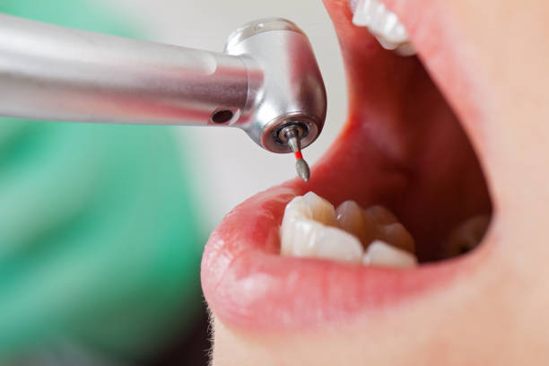 Best Emergency Dental Care for Trauma or Injury in Twin Falls, ID